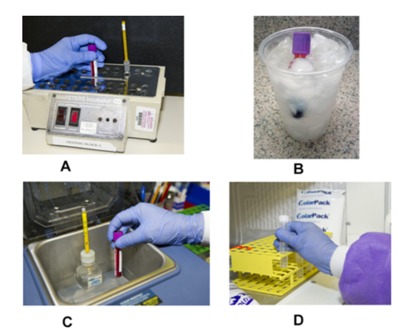 <strong> Which image represents the proper handling of specimens for cold agglutinins? (check all that apply)</strong> A) Images A, B B) Images B, D C) Images A, C D) Images D, A
