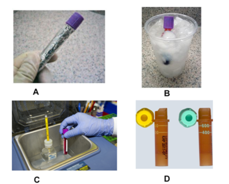 <strong> Which image represents the proper handling of specimens for bilirubin testing? (check all that apply)</strong> A) Images C, B B) Images B, D C) Images A, C D) Images A, D