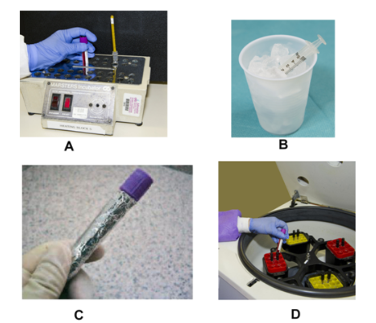 <strong> Which image represents the proper handling of specimens for blood gasses? (check all that apply)</strong> A) Image A B) Image B C) Image C D) Image D