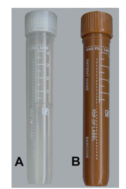 <strong> You are processing a light sensitive specimen to send out to a reference laboratory. Which image represents the most appropriate primary container?</strong> A) Image A B) Image B