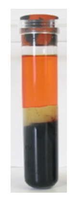 <strong> The specimen in this image needs to be recollected because</strong> A) it has an incorrect additive to blood ratio. B) RBCs have been destroyed, releasing calcium and potassium. C) coagulation proteins have been activated. D) the patient may not have been fasting.
