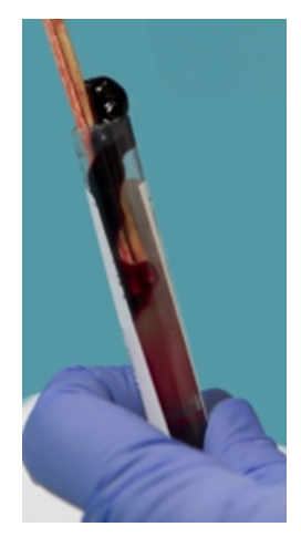 <strong> The specimen in this image needs to be recollected because</strong> A) it has an incorrect additive to blood ratio. B) RBCs have been destroyed, releasing calcium and potassium. C) coagulation proteins have been activated. D) the patient may not have been fasting.