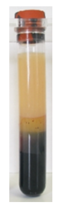 <strong> The specimen in this image needs to be recollected because</strong> A) it has an incorrect additive to blood ratio. B) RBCs have been destroyed, releasing calcium and potassium. C) coagulation proteins have been activated. D) the patient may not have been fasting.