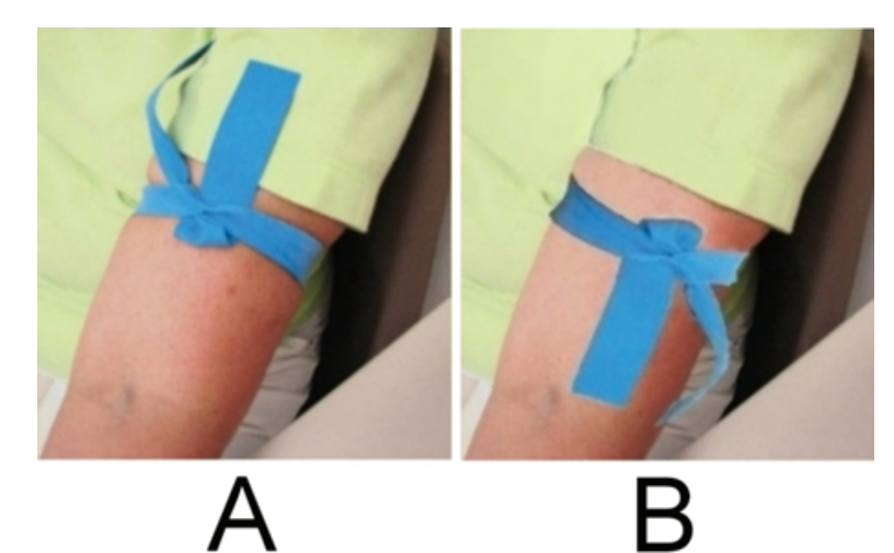 <strong> Which image provided shows the proper application of a tourniquet?</strong> A) Image A B) Image B C) All of the above