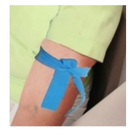 <strong> The application of the tourniquet in this image will cause</strong> A) awkward blood collection B) hematoma formation C) hemoconcentration D) no problems during blood collection