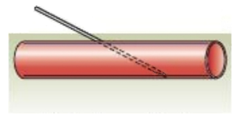 <strong> What venipuncture situation is represented by this image?</strong> A) needle against vein wall B) needle inserted too deep C) needle inserted too shallow D) proper needle insertion