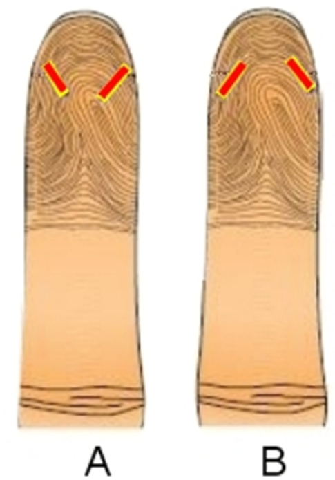 <strong> -Which of the fingersticks, in this image, is performed correctly? (choose all that apply)</strong> A) Image A B) Image B C) All of the above