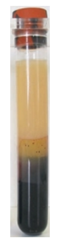 <strong> -The specimen in this image was just removed from the centrifuge and appears</strong> A) hemolyzed B) icteric C) lipemic D) normal