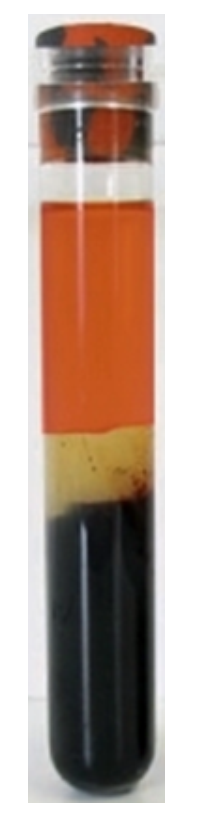 <strong> The specimen in this image was just removed from the centrifuge and appears</strong> A) hemolyzed B) icteric C) lipemic D) normal