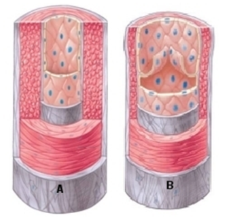 <strong>   -The blood vessel in this image that is labeled Ais a(an)</strong> A) artery B) capillary C) vein <div style=padding-top: 35px> 