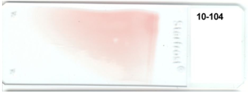 <strong> -The appearance of this blood smear is caused by using (check all that apply)</strong> A) a slide with fingerprints on it B) unequal pressure on the spreader slide C) a chipped slide for the spreader slide D) a start and stop motion