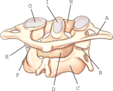 Stress from a severe whiplash type of injury may cause a fracture of the structure labeled _____.