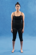 <strong> You are performing an assessment of the vertebrae and assess the posture shown in the accompanying figure. What type of posture do you see in the picture?</strong> A) Lordosis B) Scoliosis C) Kyphosis D) Normal posture