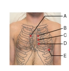 <strong> You are auscultating heart sounds using the bell of the stethoscope. You hear a swooshing sound at Erb's point. Identify the area where you hear this heart murmur.</strong> A) A B) B C) C D) D E) E