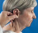 <strong> What is the nurse assessing for in the photo?</strong> A) Tenderness B) Hearing loss C) Visual deformities D) Color