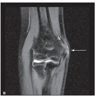   -Refer to the figure. Name the imaging modality and plane.