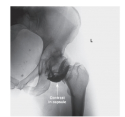   -Refer to the figure. Name this image.
