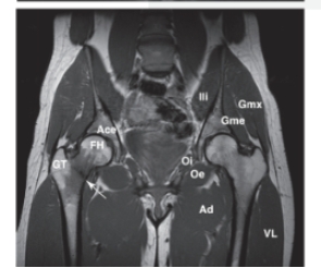   -Refer to the figure. Name the image and view.