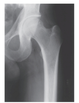 -Refer to the figure. Identify the radiographic view.