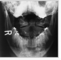 -Refer to the figure. Please identify the following view: