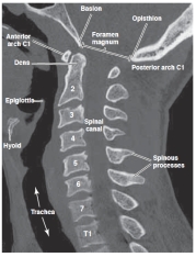 -Refer to the figure. What plane is this CT of the cervical spine?