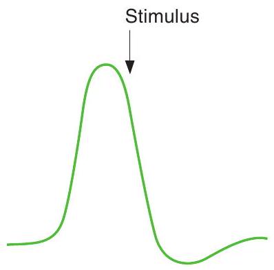 <strong>During a nerve action potential, a stimulus is delivered as indicated by the arrow shown in the following figure. In response to the stimulus, a second action potential </strong> A) of smaller magnitude will occur B) of normal magnitude will occur C) of normal magnitude will occur but will be delayed D) will occur but will not have an overshoot E) will not occur
