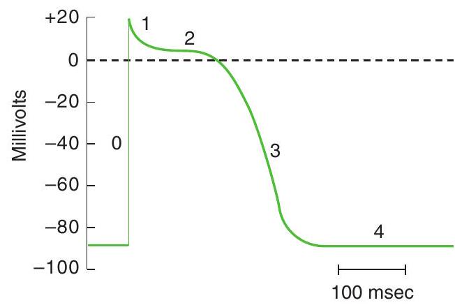 <strong>Use the diagram of an action potential to answer the following questions. -The action potential shown is from</strong> A) a skeletal muscle cell B) a smooth muscle cell C) a sinoatrial (SA) cell D) an atrial muscle cell E) a ventricular muscle cell