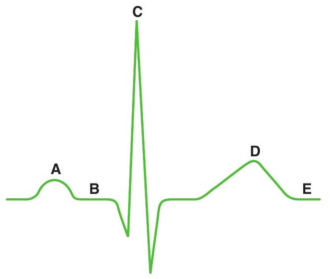 <strong>THE FOLLOWING DIAGRAM APPLIES TO THE FOLLOWING QUESTIONS -During which labeled wave or segment of the electrocardiogram (ECG) are both the atria and the ventricles completely repolarized?</strong> A) \mathrm{A} B) \mathrm{B} C) \mathrm{C} D) \mathrm{D} E) \mathrm{E}