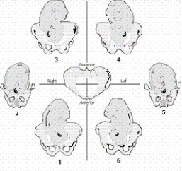 <strong>In the illustration below, which item depicts the LOT position? </strong> A) 1 B) 2 C) 3 D) 4 E) 5 F) 6