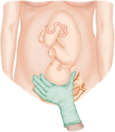 <strong>The nurse is performing Leopold's maneuvers on a client. Which figure depicts the Leopold's maneuver that determines whether the fetal presenting part is engaged in the maternal pelvis. Refer to Figures a to d</strong> A) B) C) D)