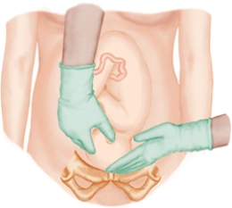 <strong>The nurse is performing Leopold's maneuvers on a client. Which figure depicts the Leopold's maneuver that determines whether the fetal presenting part is engaged in the maternal pelvis. Refer to Figures a to d</strong> A) B) C) D)
