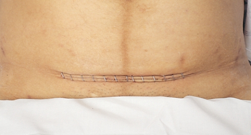 <strong>The nurse is performing a postpartum assessment on a client and concludes with the assessment depicted in the figure. Which is the rationale for performing the depicted assessment? </strong> A) Check for edema. B) Check for range of motion. C) Check for adequate reflexes. D) Check for deep vein thrombosis.