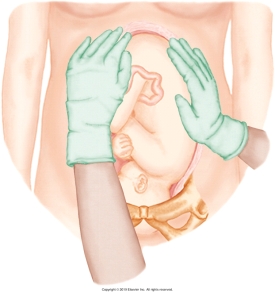 <strong>The nurse is performing Leopold's maneuvers on her patient. Which figure depicts the Leopold's maneuver that determines whether the fetal presenting part is engaged in the maternal pelvis? Refer to Figures A to D.</strong> A) B) C) D)