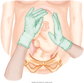 <strong>The nurse is performing Leopold's maneuvers on her patient. Which figure depicts the Leopold's maneuver that determines whether the fetal presenting part is engaged in the maternal pelvis? Refer to Figures A to D.</strong> A) B) C) D)