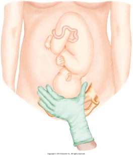 <strong>The nurse is performing Leopold's maneuvers on her patient. Which figure depicts the Leopold's maneuver that determines whether the fetal presenting part is engaged in the maternal pelvis? Refer to Figures A to D.</strong> A) B) C) D)