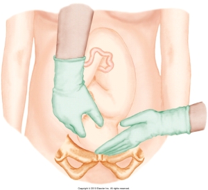 <strong>The nurse is performing Leopold's maneuvers on her patient. Which figure depicts the Leopold's maneuver that determines whether the fetal presenting part is engaged in the maternal pelvis? Refer to Figures A to D.</strong> A) B) C) D)