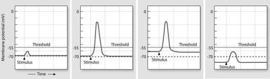 In the graphs below, identify normokalemia, hyperkalemia, and hypokalemia.