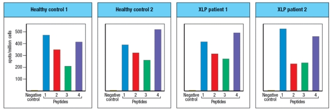 <strong>Patients with X-linked lymphoproliferative syndrome type 1 (XLP1) have mutations in the SLAM-family adapter protein, SAP. These patients suffer from an inability to control infections of the herpesvirus Epstein-Barr virus (EBV) that infects B cells. Studies have been done using peripheral blood T cells from these patients to examine their response to EBV in comparison to the responses of normal individuals (EBV-infected) as controls. These data were obtained by ELISPOT analysis, to quantify the numbers of IFN- \gamma -producing CD8 T cells per million peripheral blood leukocytes in response to several EBV peptides, indicated as peptide 1, 2, 3, or 4 (note: the patients and controls were matched for HLA class I molecules). These results indicate that:</strong> A) XLP patients have a defect in priming CD8 T cell responses following EBV infection. B) XLP patients require IFN- \gamma production to kill EBV-infected B cells. C) XLP patients have normal CD8 effector cell priming following EBV infection. D) XLP patients have a defect in cytotoxicity by NK cells rather than by CD8 T cells. E) XLP patients have no defect in cytotoxicity by CD8 T cells.