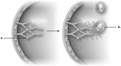 <strong>Figure 19.1 In immune complex reaction shown in Figure 19.1, what is the end result of the reaction?</strong> A) Complement is activated. B) Neutrophils are attracted and release enzymes. C) Antibodies destroy neutrophils. D) IgG is directed against cell membrane antigens. E) Endothelial cells are damaged.