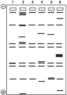 <strong>Figure 10.3 This figure shows the results of a gel electrophoresis separation of restriction fragments of the DNA of different organisms. In Figure 10.3, which two are most closely related?</strong> A) 2 and 5 B) 4 and 5 C) 2 and 4 D) 1 and 3 E) 3 and 5