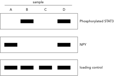 <strong>Neuronal samples from wild-type mice were monitored in the absence and presence of leptin via Western blotting. The data are shown below. Choose the answer that correctly identifies the NPY/AGRP neuronal samples obtained in the absence and then the presence of leptin. </strong> A) B; C B) D; B C) A; C D) C; A