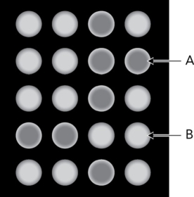 <strong>The figure below is a fluorescence readout from a lectin array. What can be deduced from B? </strong> A) There is no interaction between the glycan and the lectin in the well. B) There is a glycan-lectin interaction in the well. C) There is an interaction, but there is no way to determine the species that are interacting. D) Glycan cleavage from the glycoconjugate has been achieved.