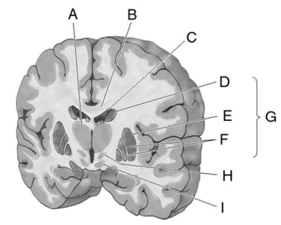 Match the letter to the correct brain structure. _____ 1. caudate nucleus _____ 2. lateral ventricle _____ 3. basal ganglia _____ 4. substantia nigra _____ 5. subthalamic nucleus _____ 6. thalamus _____ 7. putamen _____ 8. globus pallidus _____ 9. corpus callosum