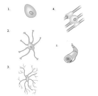 <strong>Match the pictures to their name.   </strong> A)microglial cell _____ B)ependymal cell_____ C)oligodendroglial cell_____ D)Schwann cell_____ E)astrocyte _____ <div style=padding-top: 35px> 