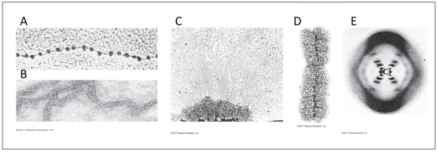 <strong> The images above are of DNA at various levels of coiling and folding.Use this image to answer the questions below. Which image represents the smallest level of DNA visualization?</strong> A)A B)B C)C D)D E)E