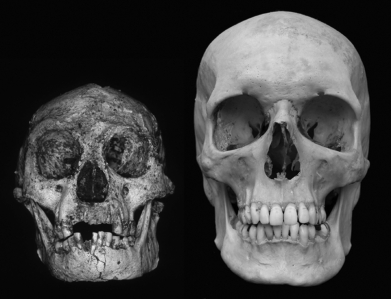 <strong>What is one possible explanation offered by some scholars to explain the Hobbit of Flores Island, Indonesia? </strong> A) The island climate evolved a unique species of human in a very short period of time. B) This is a case of mixed-species breeding. C) The Hobbit is actually not a human fossil at all. D) This is a case of microcephaly.
