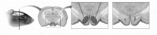 -(see Figure 1.14) In this illustration, a lesion is being produced in the rat's ____________________.