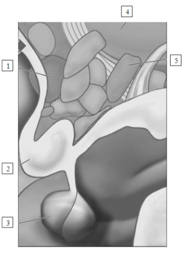 <strong>(see Figure 9.6) Bernice is studying for a quiz. She writes in her notes that the structure labeled #1 is called the </strong> A) posterior hypothalamus. B) septal area. C) pituitary gland. D) POA of the hypothalamus.