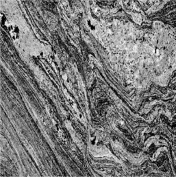 <strong>What type of rock is shown in the picture? </strong> A)clastic B)sedimentary C)igneous D)metamorphic