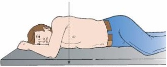 <strong>The body position depicted below results in which x-ray projection? </strong> A) PA oblique B) AP oblique C) Recumbent D) Mediolateral
